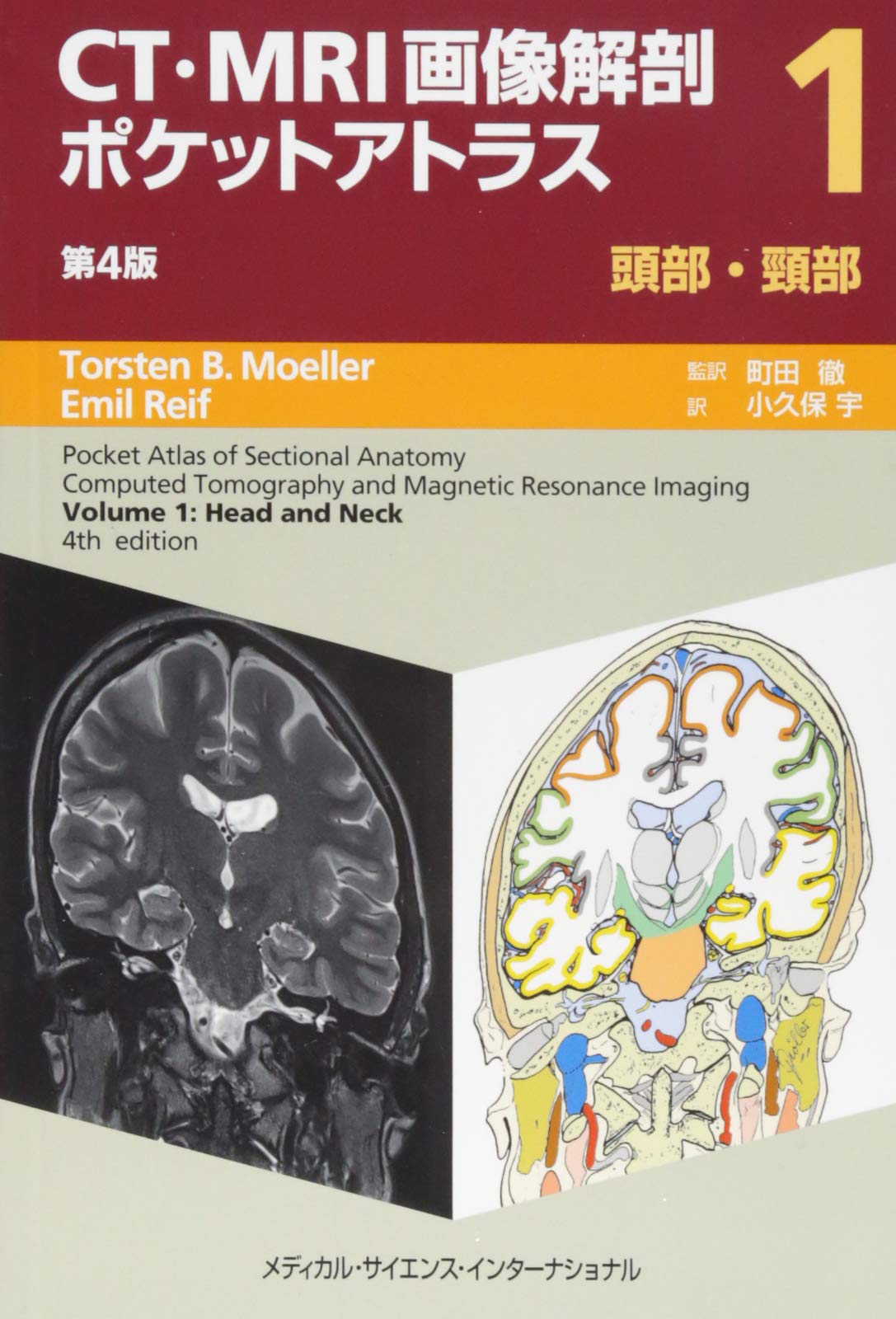 CT・MRI화상 해부 포켓 아틀라스 제4판 I권머리 부분・목부
