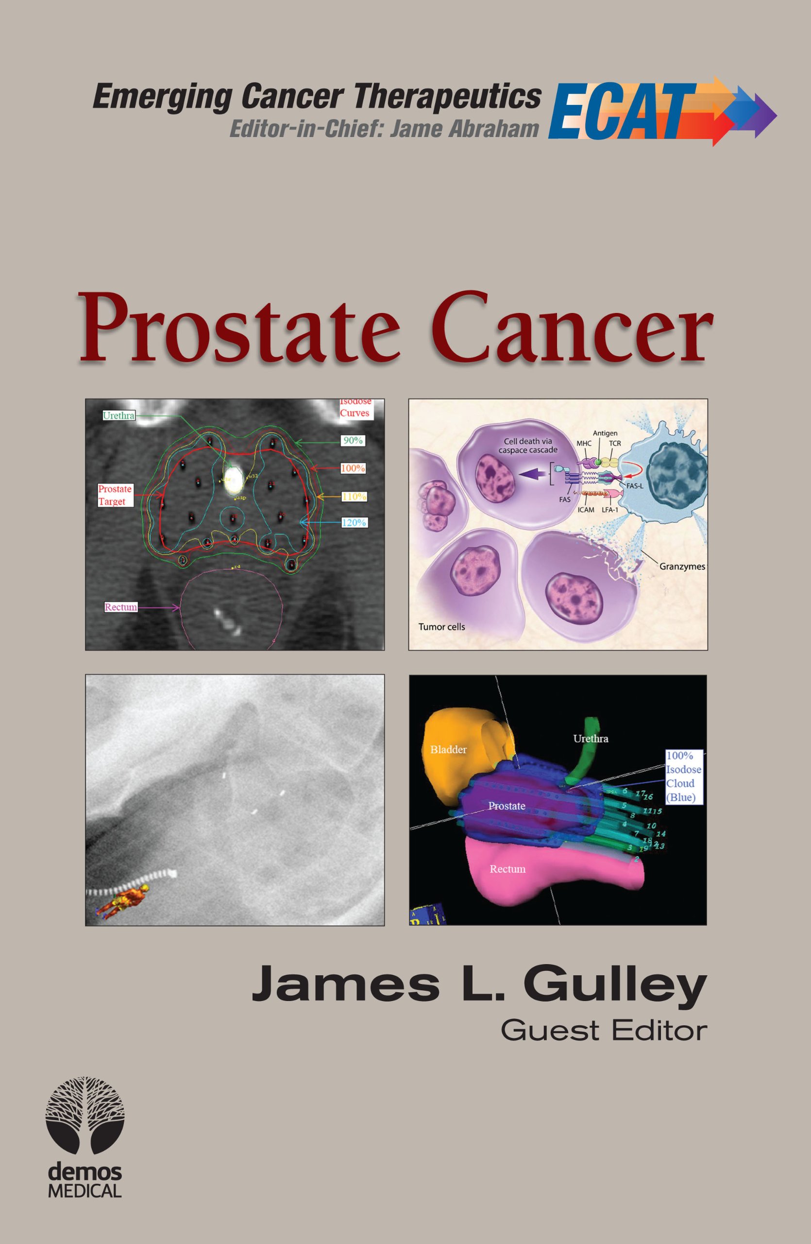 Prostate Cancer (Emerging Cancer Therapeutics Book 2)